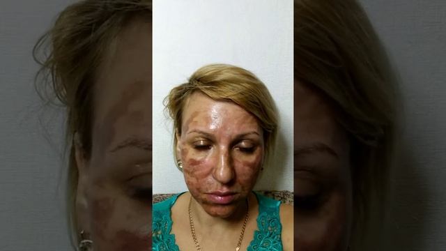 Последствия пилинга смотреть онлайн
