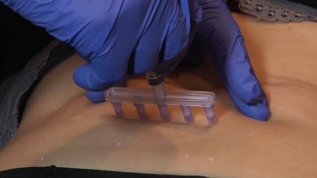 Dermaheal LL Dr Miori