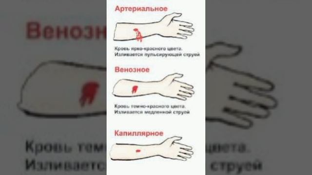 Базовые основы пожилой тактической медицины от НЕ пожилых дикарей. смотреть онлайн