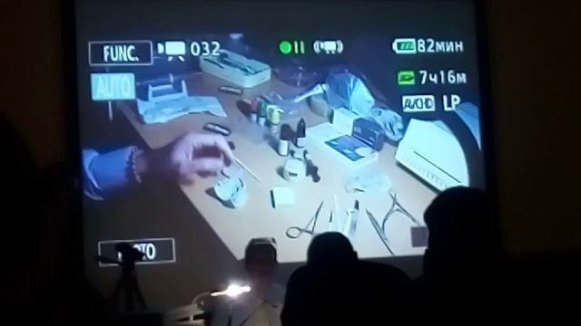Композитные виниры системы Visio.lighn от фирмы bredent смотреть онлайн