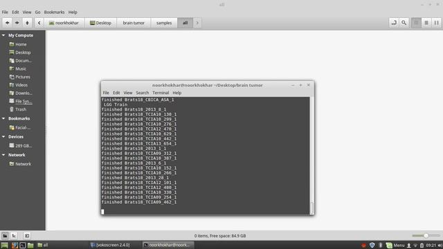 Brain Tumor Image Segmentation using Python and OpenCV смотреть онлайн