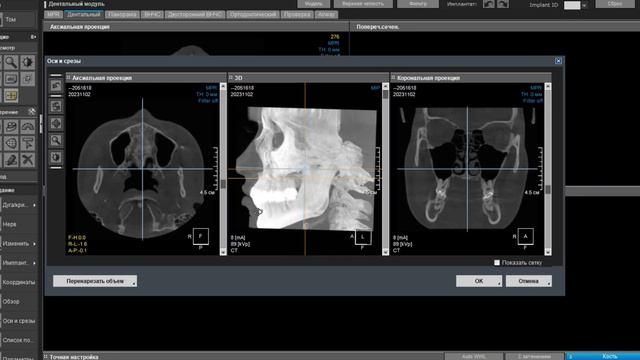 OnDemand 3D Dental from cbct to panoramic view. Делаем из клкт в панормный вид смотреть онлайн