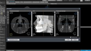 OnDemand 3D Dental from cbct  to panoramic view. Делаем из клкт в панормный вид