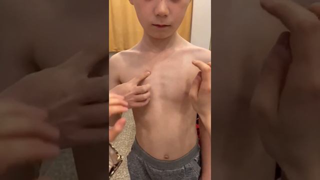 Тамыр будасының енін анықтау смотреть онлайн