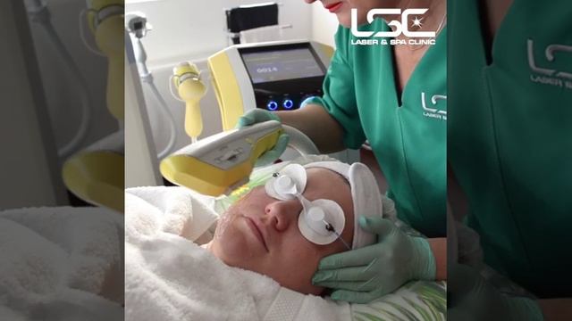 IPL фотоомоложение на аппарате BTL Exilite смотреть онлайн