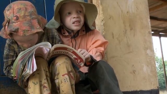 Что значит быть альбиносом в Танзании! смотреть онлайн