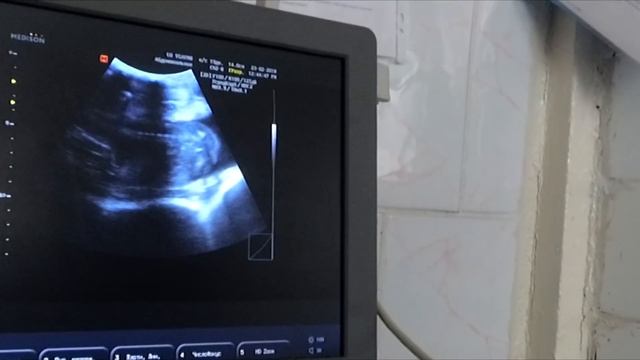 Узи козам смотреть онлайн
