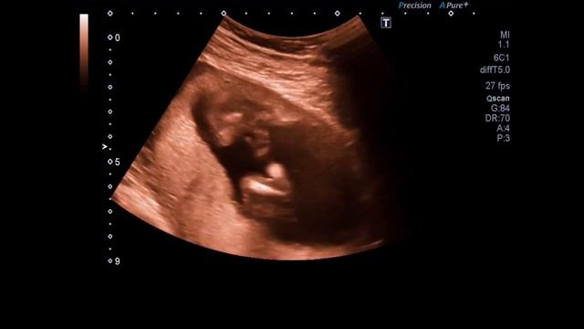 КАК ОПРЕДЕЛИТЬ ДАТУ РОЖДЕНИЯ РЕБЕНКА | 5 хитрых способов как рассчитать дату родов смотреть онлайн