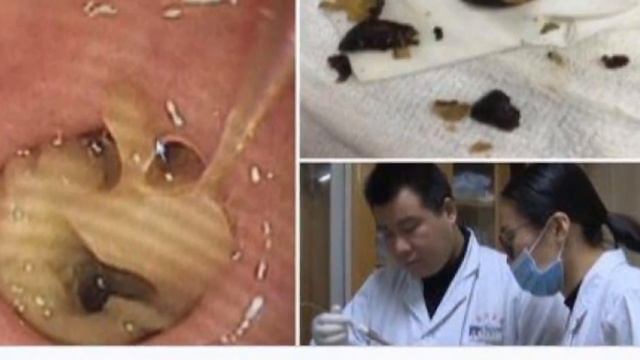 У китаянки в животе выросли грибы/Любопытные факты смотреть онлайн