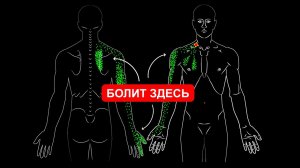 Болит рука и лопатка, немееют пальцы кисти? Срочно проверь лестничные мышцы!