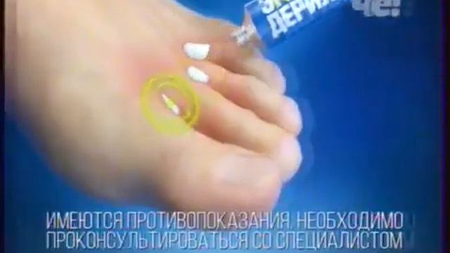 Реклама Крем Экзодерил - Декабрь 2019 смотреть онлайн