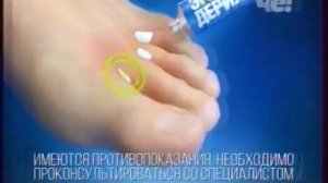 Реклама Крем Экзодерил - Декабрь 2019