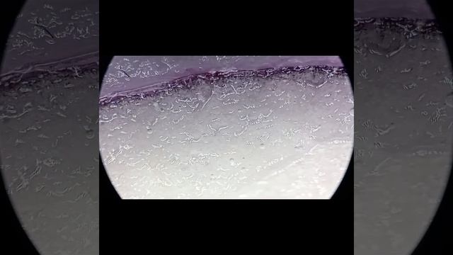 Почему Фиолетовый Лук Полезен Для Человека #youtubevideo #underthemicroscope #microworld