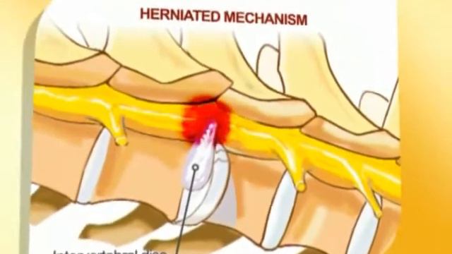 Royal Canin Dachshund Nutrition смотреть онлайн