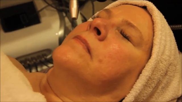 Jet Peel смотреть онлайн