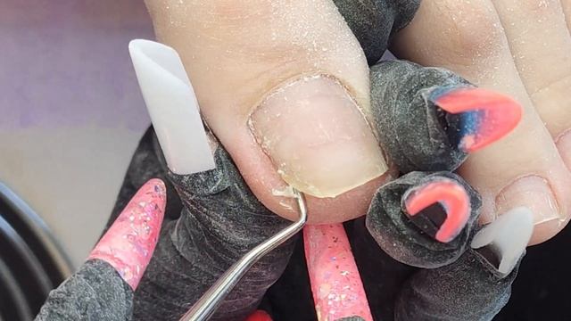 ВРОСШИЙ НОГОТЬ. ТАМПОНАДА ВРОСШЕГО НОГТЯ. ПОЧЕМУ НЕЛЬЗЯ ПЕРЕНАШИВАТЬ ПОКРЫТИЕ. ГИДРОЗНАЯ СТОПА смотреть онлайн