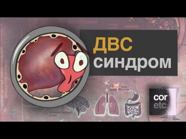 ДВС-синдром (синдром диссеминированного внутрисосудистого свертывания)
