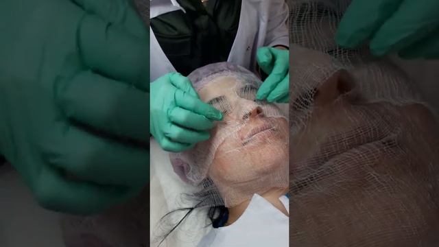 Копия эксфолиация смотреть онлайн