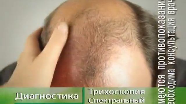 Трихология для мужчин смотреть онлайн