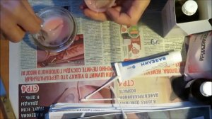 Перебазировка зубных протезов на дому ! 9 февраля 2023 год