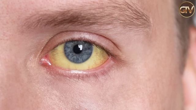 Gianluca Vialli, parla il dottore che l’ha operato: “fate attenzione a questo...” смотреть онлайн