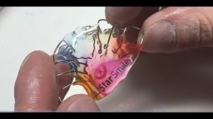 Изготовление пластинки для зубов -  старые и болезненные технологии лечения прикуса