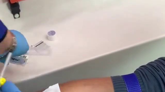 Венозды катетрді қою техникасы смотреть онлайн