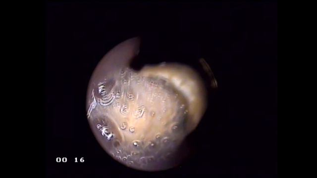 Removal of foreign body from the esophagus in a cat. Удаление инородного тела из пищевода у кошки. смотреть онлайн