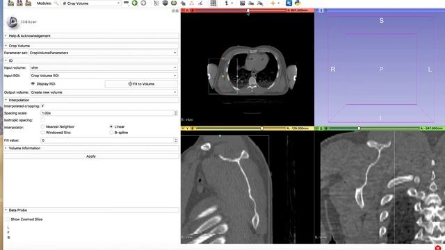Slicer Crop Volume смотреть онлайн