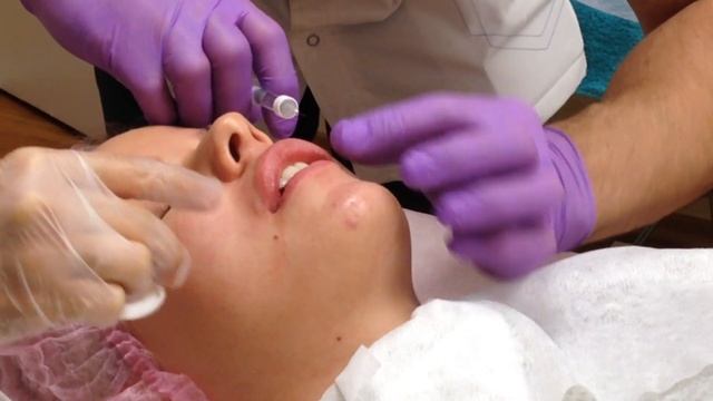 АирисКом студенты учатся: повышение квалификации для врачей. Плоские губы. Французская методика.