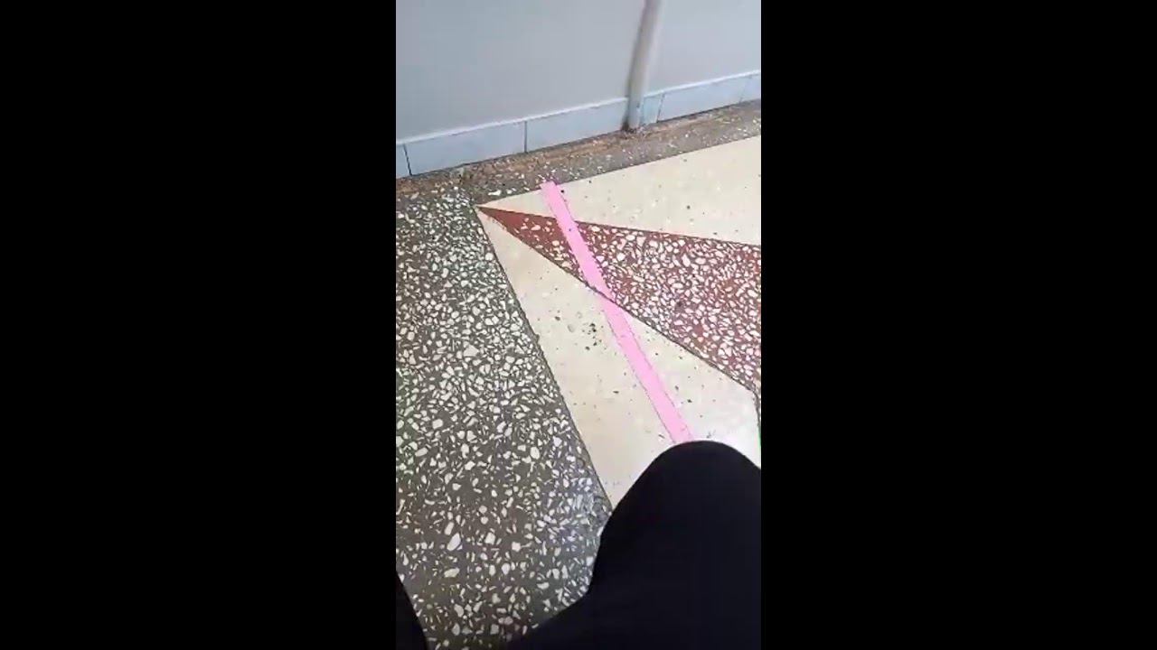 ждем когда зуб вырвут