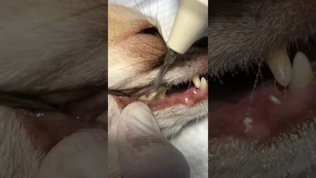 Ультразвуковая чистка зубов ??? смотреть онлайн