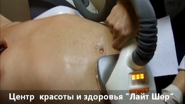 Убираем мужской живот с Вела Шейп смотреть онлайн