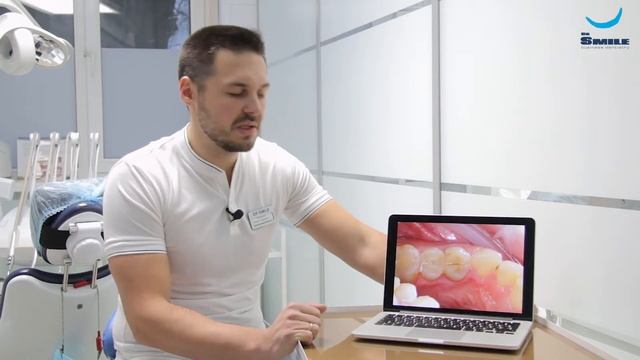 Скол зуба. Дентальная имплантация. Капранов М.Ю. (Клиника Dr.Smile) смотреть онлайн