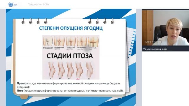 Запись вебинара: Тредлифтинг BODY смотреть онлайн
