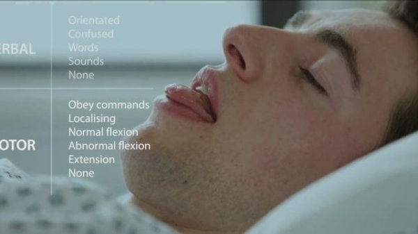 Glasgow Coma Scale at 40 | The new approach to Glasgow Coma Scale assessment