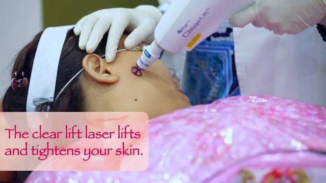 Clear Lift Laser || Diwali Special || Skinfiniti смотреть онлайн