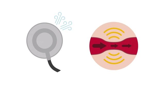 Auscultating the abdomen смотреть онлайн