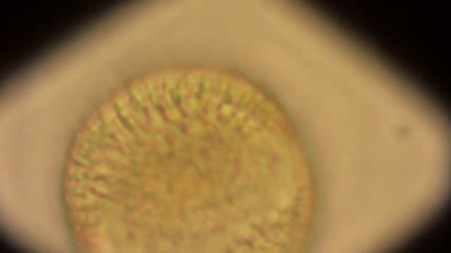 Мед Под Микроскопом: Рассказ о Турецком Меде Увел X1000 Turkish Honey Under Microscope смотреть онлайн