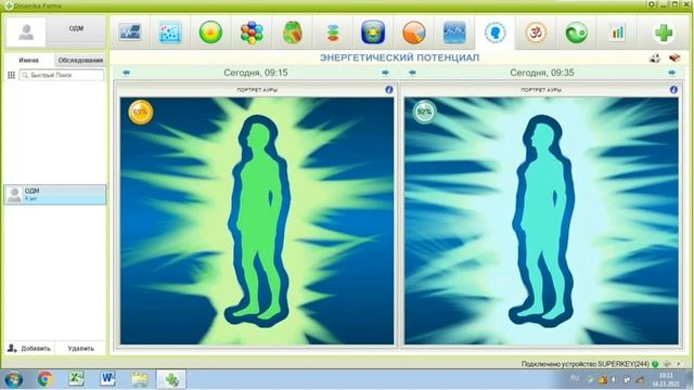 Тестирование капель лор MAGIC NOSE на аппарате «Динамика Фарма» 18.11.2021 смотреть онлайн
