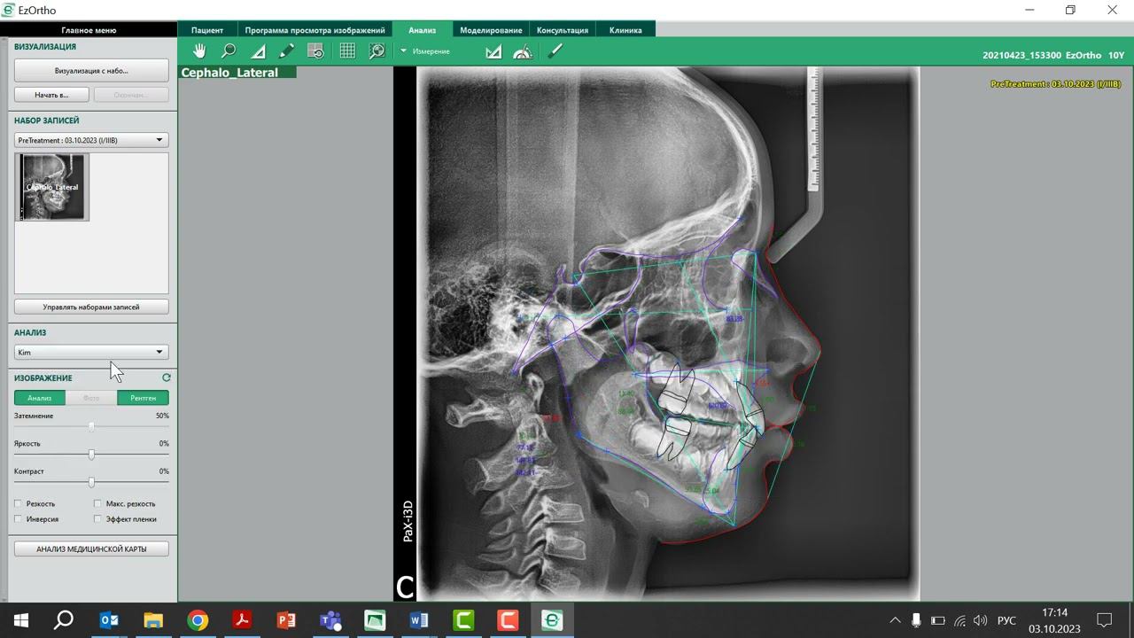 EzOrtho краткое начало смотреть онлайн