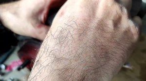 Не отпускает ручник колесо, подклинивает ручник на Hyundai Elantra MD 5 | дёргается при трогинии??