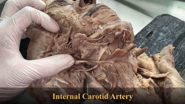 Dissection of Submandibular region & styloid appratus смотреть онлайн