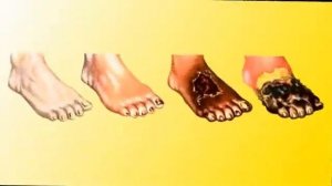 Синий йод. Универсальное и эффективное средство от многих болезней.