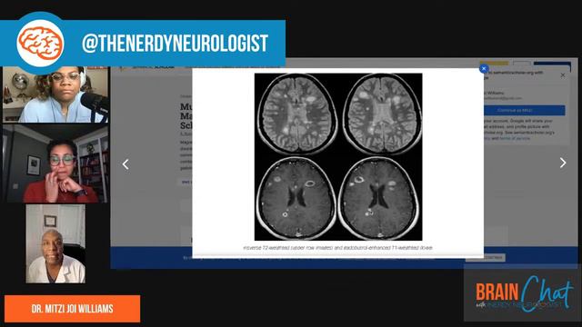 Brain Chat w/ the Nerdy Neurologist смотреть онлайн