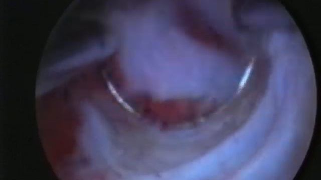 Конференция по гистероскопии 1 смотреть онлайн