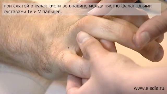 Скорая помощь при потере сознания смотреть онлайн