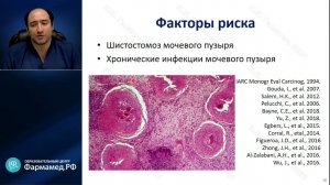 Рак мочевого пузыря.  Современные методы диагностики и лечения. (д.м.н. Гаджиев Н.К.)