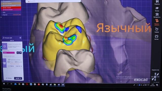 Моделировка зуба от А до Я в exocad 3 0 смотреть онлайн