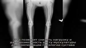 Дисплазия у собак